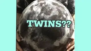 TWINS 👶🏻👶🏻 big twin belly progression!