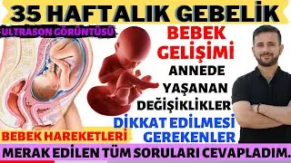 35 Weekly Pregnancy (2020)
