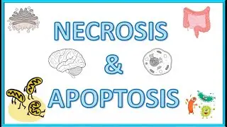 Cell Death : Necrosis & Apoptosis - Types, Morphology, Causes, Mechanism & Clinical Significance
