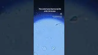 Human Sperms under microscope!