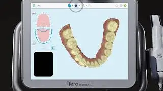 Adding a new case type | iTero™ scanner tutorial