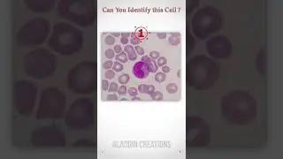 Can you Identify  this Immature WBC ? 🧐👀🧠  #Quiz 98