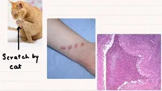 16- GENERAL HEMATOLOGY LECTURE 16 :Granuloma: MONOCYTE , MACROPHAGE  ماكروفاج