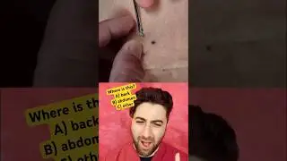 Multiple dilated pore extractions but where is it?