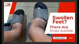 Shoes For Swollen Feet - They're Availible!