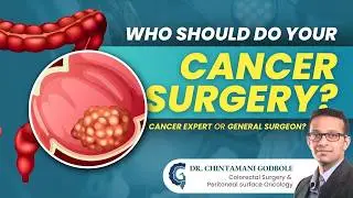 Does Your Cancer Surgeon's Specialisation Affect Your Survival? | Colon Cancer Awareness Month