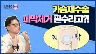 피막 제거를 꼭 해야 하는 경우 vs 안 해도 되는 경우 I 가슴재수술 전 피막제거 24년 최신 영상!