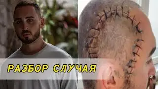 Разбор случая Олексея Остаповского