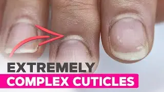 Shocking Cuticle Cleanup You Need to See | Overgrown Cuticles