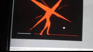 ms pain