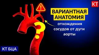 Вариантная анатомия отхождения сосудов от дуги аорты