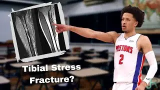 Cade Cunningham Tibial Stress Fracture Explained
