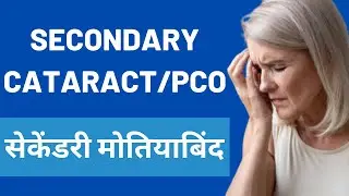 Secondary Cataracts or PCO | सेकेंडरी मोतियाबिंद