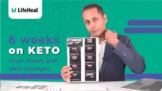 6 Weeks On Keto | Ketogenic Diet | Weightloss | Metabolic Health | Junior Gupta
