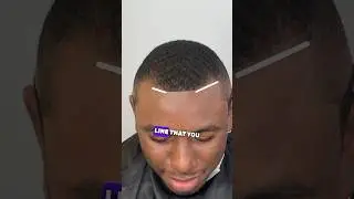 Fix Hairline No Enhancement Black Spray‼️ 💈 