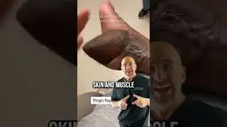 Skin Flap Reconstruction 