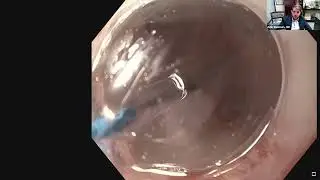 trūFreeze CryoDilation Talk – Dr. Amir Rumman