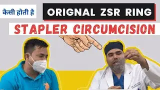 मरीज ने दिखायी अपनी ZSR SILICON RING | ZSR CIRCUMCISION IN INDIA