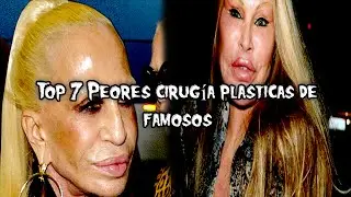 Top 7 Peores cirugía plasticas de famosos