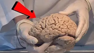 What made Albert Einstein a Genius? | क्यो अल्बर्ट आइंस्टीन बुद्धिमान थे? | Was Einstein a Genius?