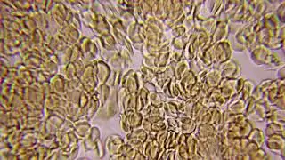 Red Blood Cells at 1000x