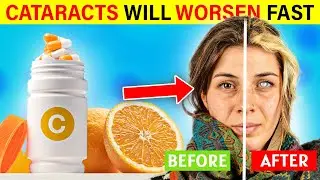 STOP OVERDOSING! 3 Vitamins That Will Damage Your Eyes⎜Dr. Neal Adams