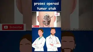 proses operasi tumor otak 