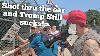 Shot In The Ear, And Trump Still Sucks! #Trump