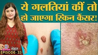 जानिए क्यों हो जाता है Skin Cancer और उससे बचने के उपाय Doctors से | Sehat Ep 33