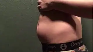 Triplet Pregnancy - Belly Bump Progression