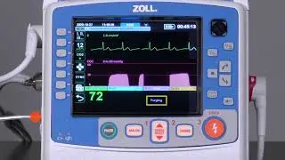 X Series® Advanced: Capnography (English)
