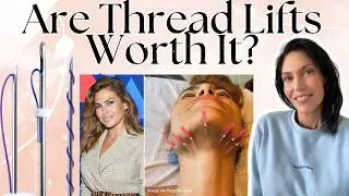 Are Thread Lifts Worth It? Celebrity Thread Lift Trend Explained (Pros, Cons & Cost)