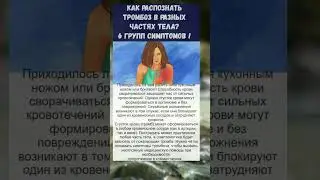 тромбоз... важно знать!