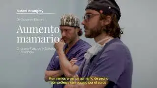 MAMOPLASTIA DE AUMENTO con prótesis semi-lisas - Dr. Giovanni Bistoni.