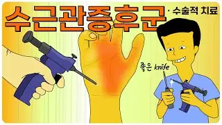 수근관 증후군 6 - 수술적 치료 (내시경-Agee, Chow 술기, 장단점, 금기)