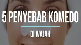 FAKTOR PENYEBAB WAJAH BERKOMEDO