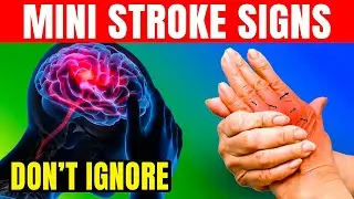 Life-Saving Tips: How to Identify Signs Of Mini Stroke in Elderly