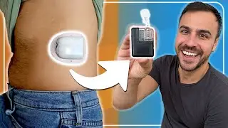 I Switched From Omnipod to Mobi – Here's How it Went