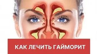 Как лечить гайморит