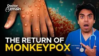 Mpox Emergency - Is a Lockdown Coming? (2024)