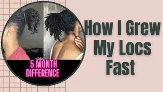 How I Grew My Locs fast in under 6 months|| tips and products to grow locs