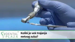 Koliki je vek trajanja mrtvog zuba?