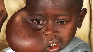 RARE HUMANS That Are One in a Million   #9