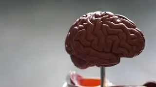 Brain Stroke
