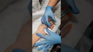 Мезотерапия рук