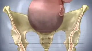 Bebeğin Doğum Kanalına Girmesi