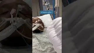 Recovery is going well 🙂 (walking without a walker now)!