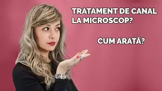 Ai de facut un tratament de canal? Vrei sa vezi cum arata un tratament endodontic?