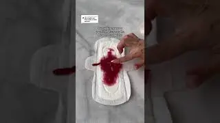 The science behind blood clots 🧐