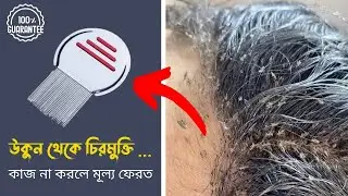 Lice Comb - উকুনের চিরুনি | এই চিরুনি দিয়ে যদি উকুন এবং উকুনের ডিম/নিট/লিক না যায় তবে মুল্য ফেরত